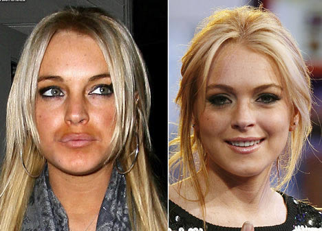 La nueva boca de Lindsay Lohan
