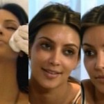 Kim Kardashian ojos morados por Botox