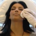 Kim Kardashian ojos morados por Botox 2