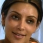 Kim Kardashian ojos morados por Botox 6